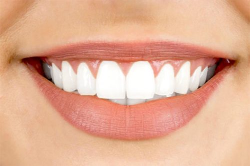 Professional teeth whitening in Fort Lauderdale