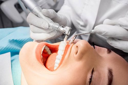 Professional dental cleaning in Fort Lauderdale