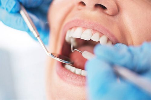 General dentistry appointment in Fort Lauderdale